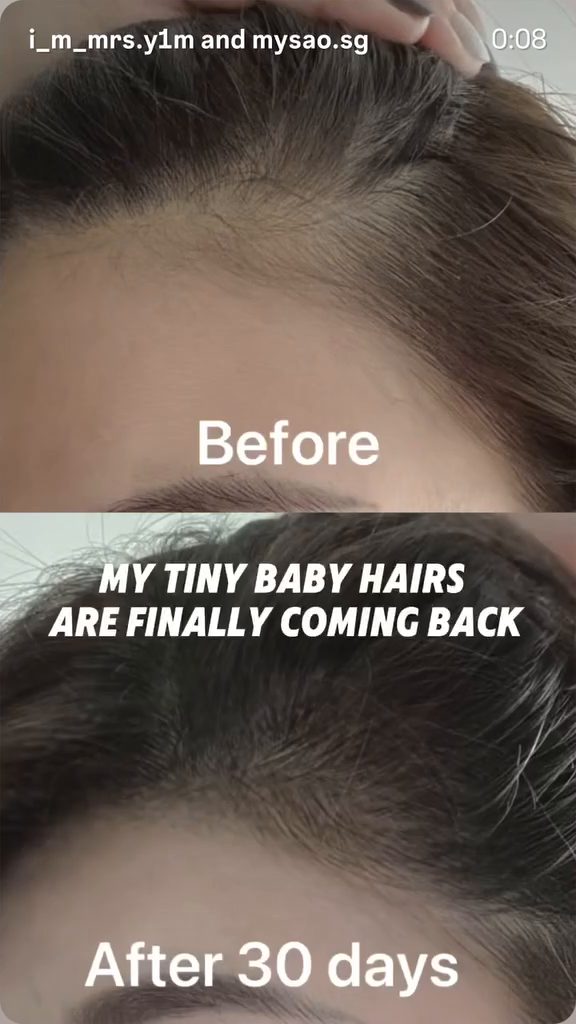 @i_m_mrs.y1m · 使用前 / 30 天後 / Before / after 30 days