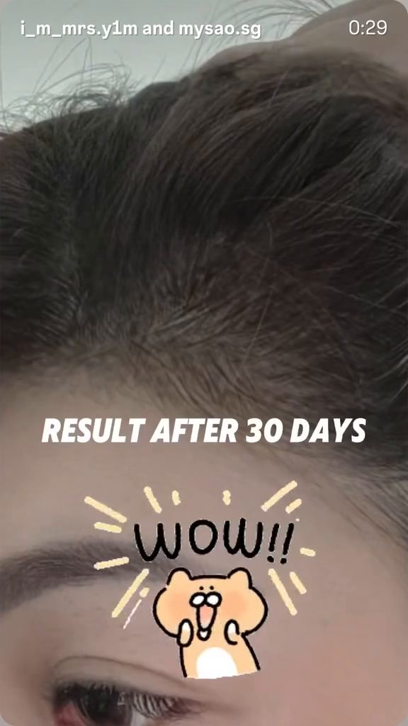 @i_m_mrs.y1m RESULT AFTER 30 DAYS