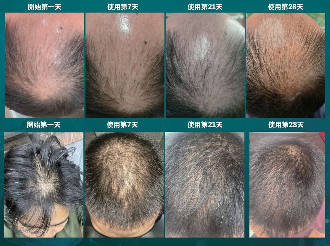 頭頂 · 兩個機位 · 28 天（1/1）/ Crown · two positions · 28 days